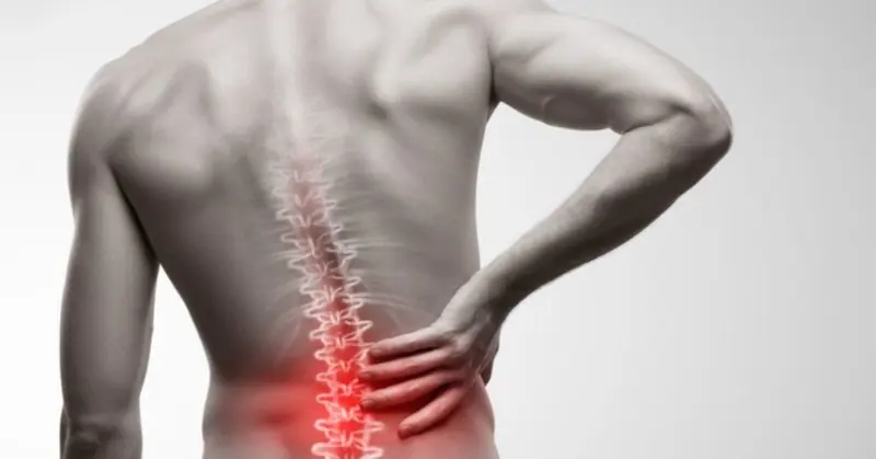 ¿Cómo saber si tengo Hernia Discal?